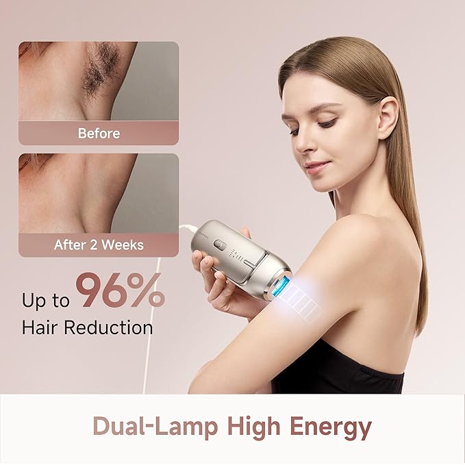 Dreame Nova IPL Hair Removal with Dual-Lamp 27J Output, Sapphire ICE Cooling, 3.9cm² Window, 0.2s Flash, Adaptizone AI Detection, Photon Skincare, Up to 96% Reduction Full-Body for Women and Men